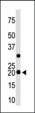 Anti-HPCAL1 Rabbit Polyclonal Antibody