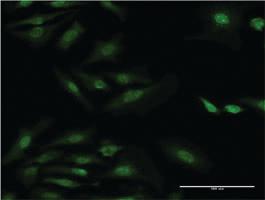 Anti-RPS29 Mouse Monoclonal Antibody [clone: 3G9]