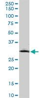 Anti-MMP26 Mouse Monoclonal Antibody [clone: 6C6]