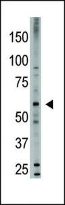 Anti-BMP6 Rabbit Polyclonal Antibody (Biotin)