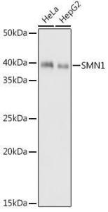 Western blot analysis of extracts of various cell lines, using Anti-SMN/Ge min 1 Antibody [ARC1710] (A308623) at 1:1000 dilution. The secondary Antibody was Goat Anti-Rabbit IgG H&L Antibody (HRP) at 1:10000 dilution. Lysates/proteins were present at 25 µg per lane