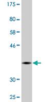 Anti-CDYL Mouse Monoclonal Antibody [clone: 1A6]