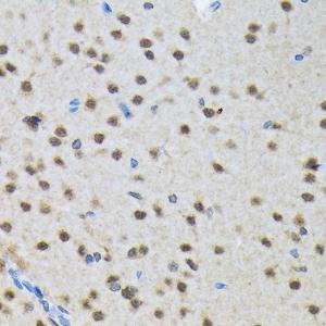 Immunohistochemistry analysis of paraffin-embedded rat brain using Anti-SMN/Ge min 1 Antibody [ARC1710] (A308623) at a dilution of 1:100 (40X lens). Perform microwave antigen retrieval with 10 mM Tris/EDTA buffer pH 9.0 before commencing with IHC staining protocol