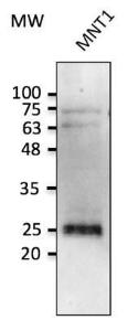 Anti-RAB38 antibody