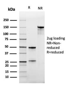 SDS-PAGE analysis of Anti-CD47 Antibody [IAP/964] under non-reduced and reduced conditions; showing intact IgG and intact heavy and light chains, respectively. SDS-PAGE analysis confirms the integrity and purity of the antibody