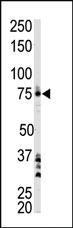 Anti-BTK Rabbit Polyclonal Antibody