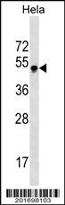 Anti-GBX2 Mouse Monoclonal Antibody