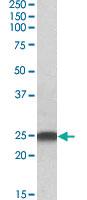 Anti-LIN7B Goat Polyclonal Antibody