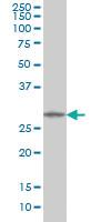 Anti-MMP26 Mouse Monoclonal Antibody [clone: 6C6]