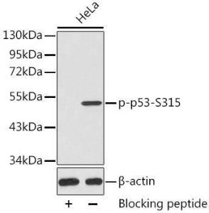 Western blot analysis of extracts from HeLa cells, using Anti-p53 (phospho Ser315) Antibody (A10954). The secondary Antibody was Goat Anti-Rabbit IgG H&L Antibody (HRP) at 1:10000 dilution. Lysates/proteins were present at 25 µg per laneThe blocking buffer used was 3% BSA