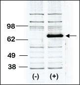 Anti-BTK Rabbit Polyclonal Antibody