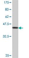 Anti-ACAT2 Mouse Polyclonal Antibody