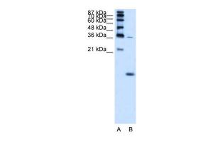 Anti-HBZ Rabbit Polyclonal Antibody