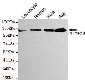 Anti-PPP1R18 Mouse Monoclonal Antibody [clone: 13k97]