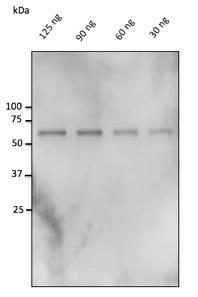 30-125 ng of catalase, isolated from bovine liver, detected with Anti-Catalase Antibody at a 1:500 dilution. Rabbit anti-goat IgG Antibody (HRP) was used at a 1:10000 dilution