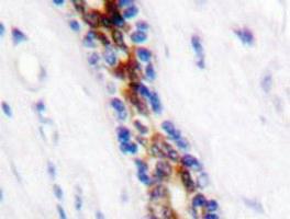 Anti-IRAK1 Rabbit Polyclonal Antibody