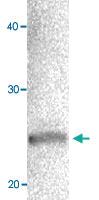 Anti-CBX1 Rabbit Polyclonal Antibody