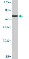 Anti-AIPL1 Mouse Monoclonal Antibody [clone: 1E1]