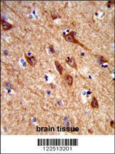 Anti-ASIC2 Rabbit Polyclonal Antibody (FITC (Fluorescein Isothiocyanate))