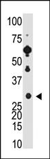 Anti-RCVRN Rabbit Polyclonal Antibody