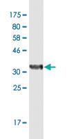 Anti-SUPT4H1 Mouse Monoclonal Antibody [clone: 3G4]