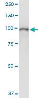 Anti-ZHX2 Polyclonal Antibody Pair