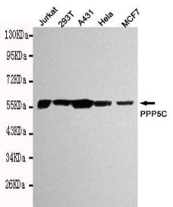 Anti-TFPI2 Mouse Monoclonal Antibody [clone: 13k101]