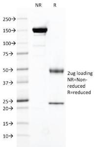 SDS-PAGE analysis of Anti-PSMA Antibody [FOLH1/2121] under non-reduced and reduced conditions; showing intact IgG and intact heavy and light chains, respectively. SDS-PAGE analysis confirms the integrity and purity of the antibody.