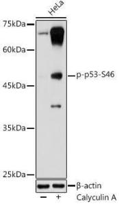 Anti-p53 (phospho Ser46) Antibody (A10961)