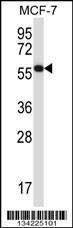 Anti-MAPKAP1 Rabbit Polyclonal Antibody