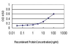 Anti-RRM1 Mouse Monoclonal Antibody [clone: 4E4]