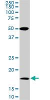 Anti-BATF Mouse Monoclonal Antibody [clone: 8A12]