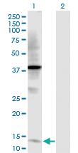 Anti-TFF2 Rabbit Polyclonal Antibody