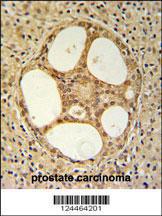 Anti-PRUNE Rabbit Polyclonal Antibody (PE (Phycoerythrin))