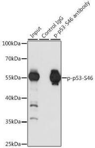 Anti-p53 (phospho Ser46) Antibody (A10961)