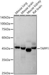 Western blot analysis of extracts of various cell lines, using Anti-TAPP-1 Antibody [ARC2927] (A308627) at 1:500 dilution. The secondary antibody was Goat Anti-Rabbit IgG H&L Antibody (HRP) at 1:10,000 dilution.