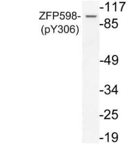 Antibody anti-ZFP598 phospho TYR306