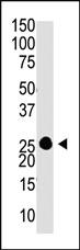 Anti-GUCA1A Rabbit Polyclonal Antibody