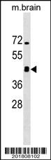 Anti-IRGM Mouse Monoclonal Antibody