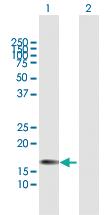 Anti-CSF3 Rabbit Polyclonal Antibody