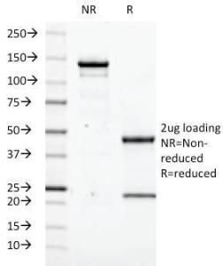 SDS-PAGE analysis of Anti-Transglutaminase II Antibody [SPM358] under non-reduced and reduced conditions; showing intact IgG and intact heavy and light chains, respectively SDS-PAGE analysis confirms the integrity and purity of the antibody