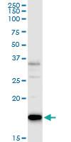 Anti-CSF3 Rabbit Polyclonal Antibody