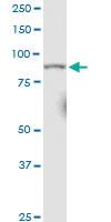 Anti-RRM1 Mouse Monoclonal Antibody [clone: 1D6]