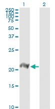 Anti-BATF Mouse Monoclonal Antibody [clone: 8A12]