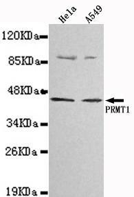 Anti-PRMT1 Mouse Monoclonal Antibody [clone: 13k106]