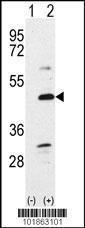 Anti-BMP7 Rabbit Polyclonal Antibody (APC (Allophycocyanin))