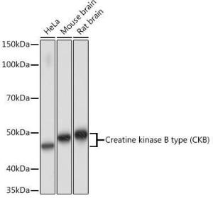 Western blot analysis of extracts of various cell lines, using Anti-Creatine Kinase MB Antibody [ARC1990] (A307604) at 1:1000 dilution. The secondary Antibody was Goat Anti-Rabbit IgG H&L Antibody (HRP) at 1:10000 dilution. Lysates/proteins were present at 25 µg per lane