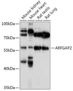 Anti-ARF GAP 2 antibody