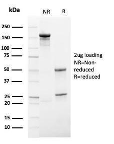 SDS-PAGE analysis of Anti-HSV1 Antibody [HSV1/4055R] under non-reduced and reduced conditions; showing intact IgG and intact heavy and light chains, respectively SDS-PAGE analysis confirms the integrity and purity of the antibody