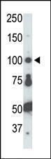 Anti-FER Rabbit Polyclonal Antibody